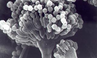 El hongo Aspergillus nidulans. Foto: http://public.gettysburg.edu/~rcavalie/em/sem.html 